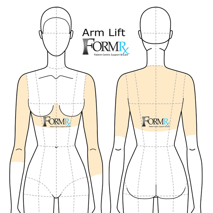 Fitting diagram showing upper-body and arm compression coverage